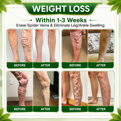 🇺🇸👩‍⚕️𝐎𝐟𝐟𝐢𝐜𝐢𝐚𝐥 𝐁𝐫𝐚𝐧𝐝 𝐒𝐭𝐨𝐫𝐞 |🌿𝑮𝒓𝒆𝒆𝒏𝑭𝒆𝒆𝒍® 𝑩𝒆𝒓𝒃𝒆𝒓𝒊𝒏𝒆 𝑴𝒐𝒓𝒊𝒏𝒈𝒂- 𝑩𝒆𝒆 𝑽𝒆𝒏𝒐𝒎 Metabolic Wellness Detox Foot Soak Beads
