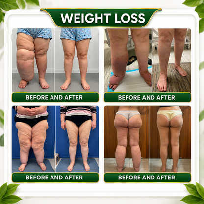🇺🇸👩‍⚕️𝐎𝐟𝐟𝐢𝐜𝐢𝐚𝐥 𝐁𝐫𝐚𝐧𝐝 𝐒𝐭𝐨𝐫𝐞 |🌿𝑮𝒓𝒆𝒆𝒏𝑭𝒆𝒆𝒍® 𝑩𝒆𝒓𝒃𝒆𝒓𝒊𝒏𝒆 𝑴𝒐𝒓𝒊𝒏𝒈𝒂- 𝑩𝒆𝒆 𝑽𝒆𝒏𝒐𝒎 Metabolic Wellness Detox Foot Soak Beads